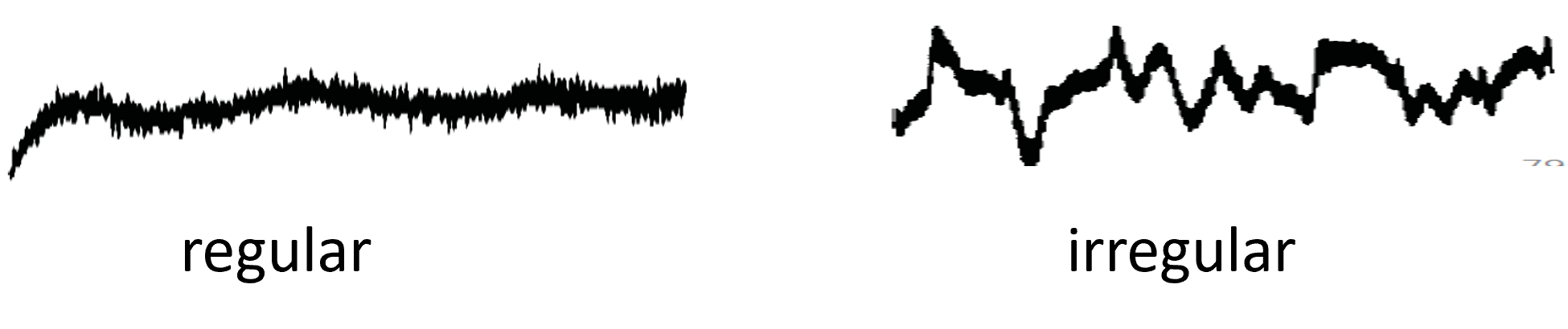 Lignes de base bruyantes